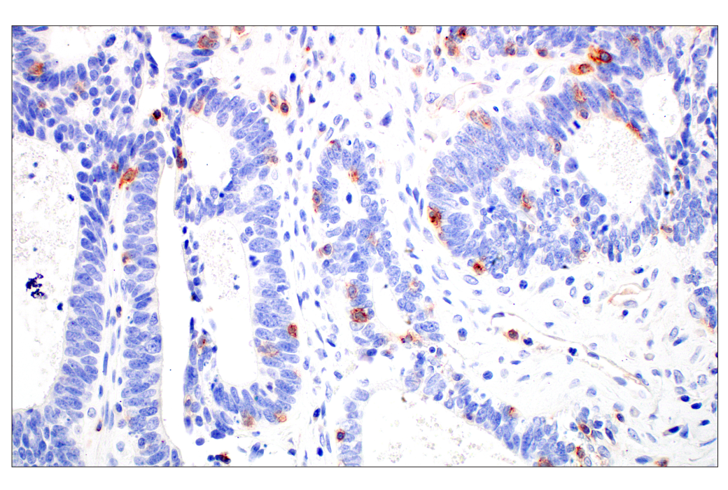 Immunohistochemistry Image 7: CD70 (E3Q1A) Rabbit mAb