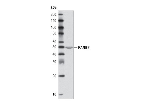 Western Blotting Image 1: PANK2 Antibody (Mouse Specific)