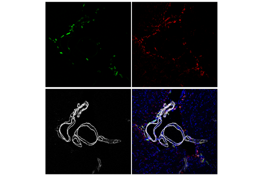 Immunofluorescence Image 2: LYVE-1 (E3L3V) Rabbit mAb (Alexa Fluor® 488 Conjugate)