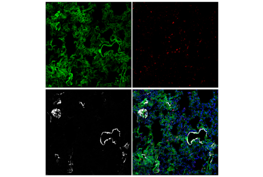 Immunofluorescence Image 4: LYVE-1 (E3L3V) Rabbit mAb (Alexa Fluor® 488 Conjugate)