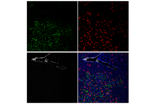 Immunofluorescence Image 1: LYVE-1 (E3L3V) Rabbit mAb (Alexa Fluor® 488 Conjugate)