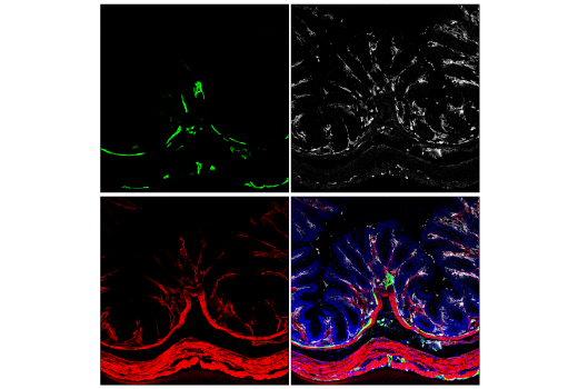 Immunofluorescence Image 3: LYVE-1 (E3L3V) Rabbit mAb (Alexa Fluor® 488 Conjugate)