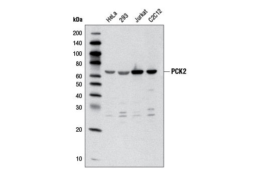 Western Blotting Image 1: PCK2 Antibody