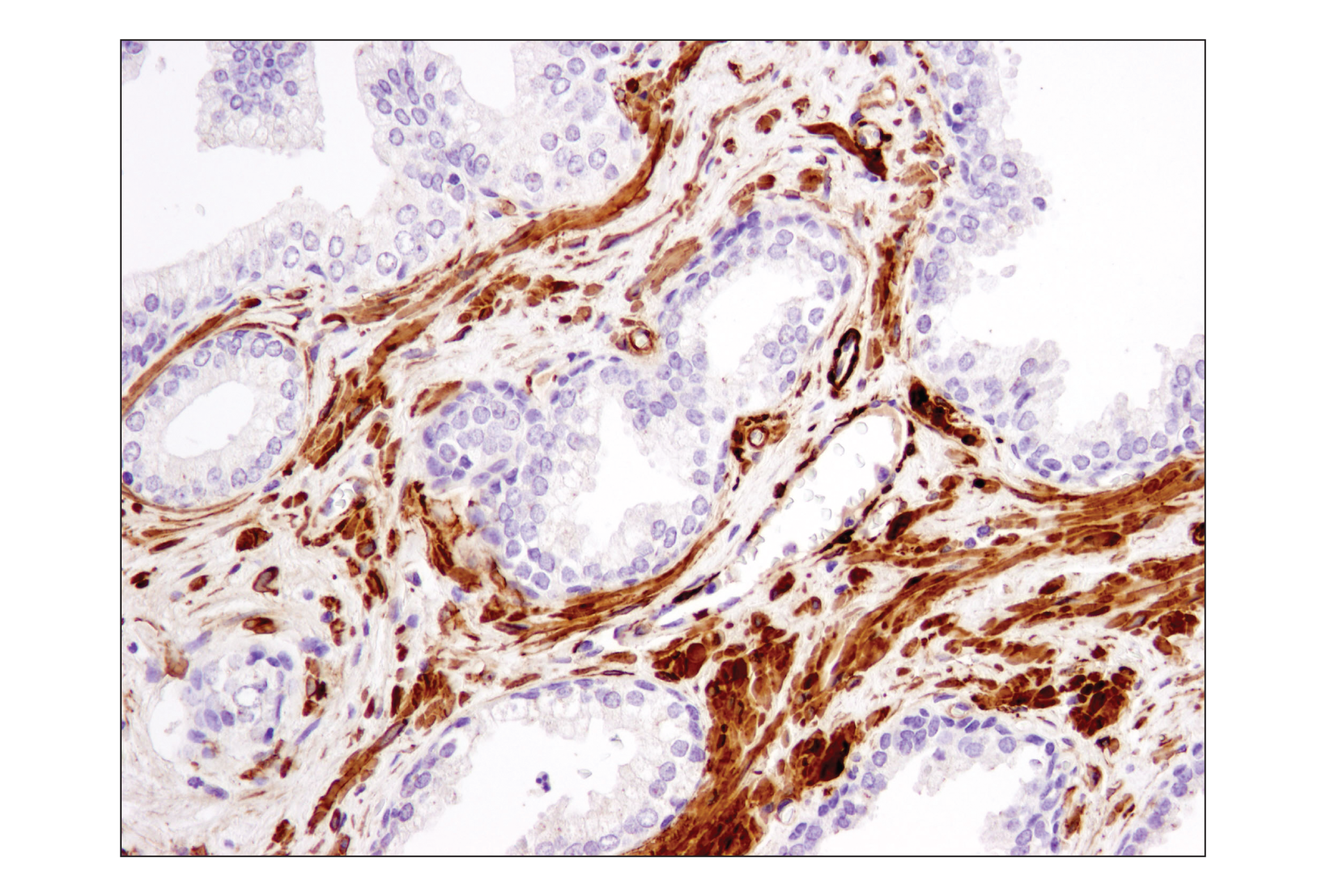 Immunohistochemistry Image 1: α-Smooth Muscle Actin (1A4) Mouse mAb (BSA and Azide Free)