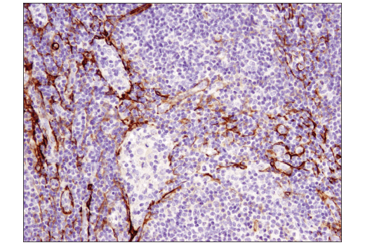 Immunohistochemistry Image 2: α-Smooth Muscle Actin (1A4) Mouse mAb (BSA and Azide Free)