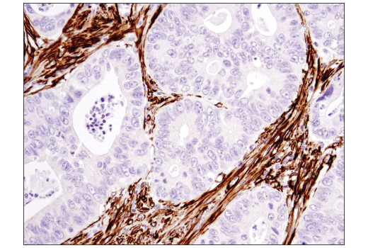 Immunohistochemistry Image 3: α-Smooth Muscle Actin (1A4) Mouse mAb (BSA and Azide Free)