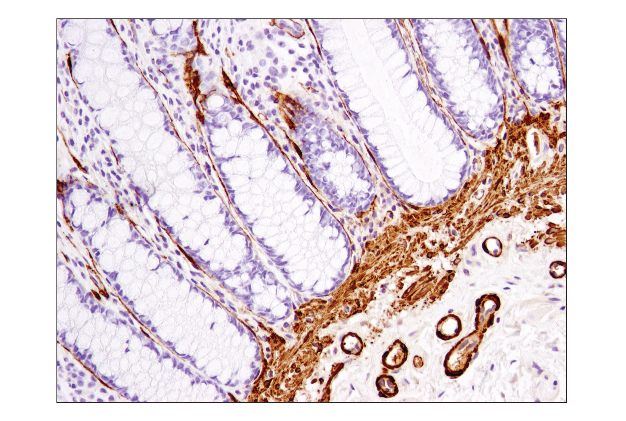 Immunohistochemistry Image 4: α-Smooth Muscle Actin (1A4) Mouse mAb (BSA and Azide Free)
