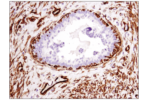 Immunohistochemistry Image 5: α-Smooth Muscle Actin (1A4) Mouse mAb (BSA and Azide Free)