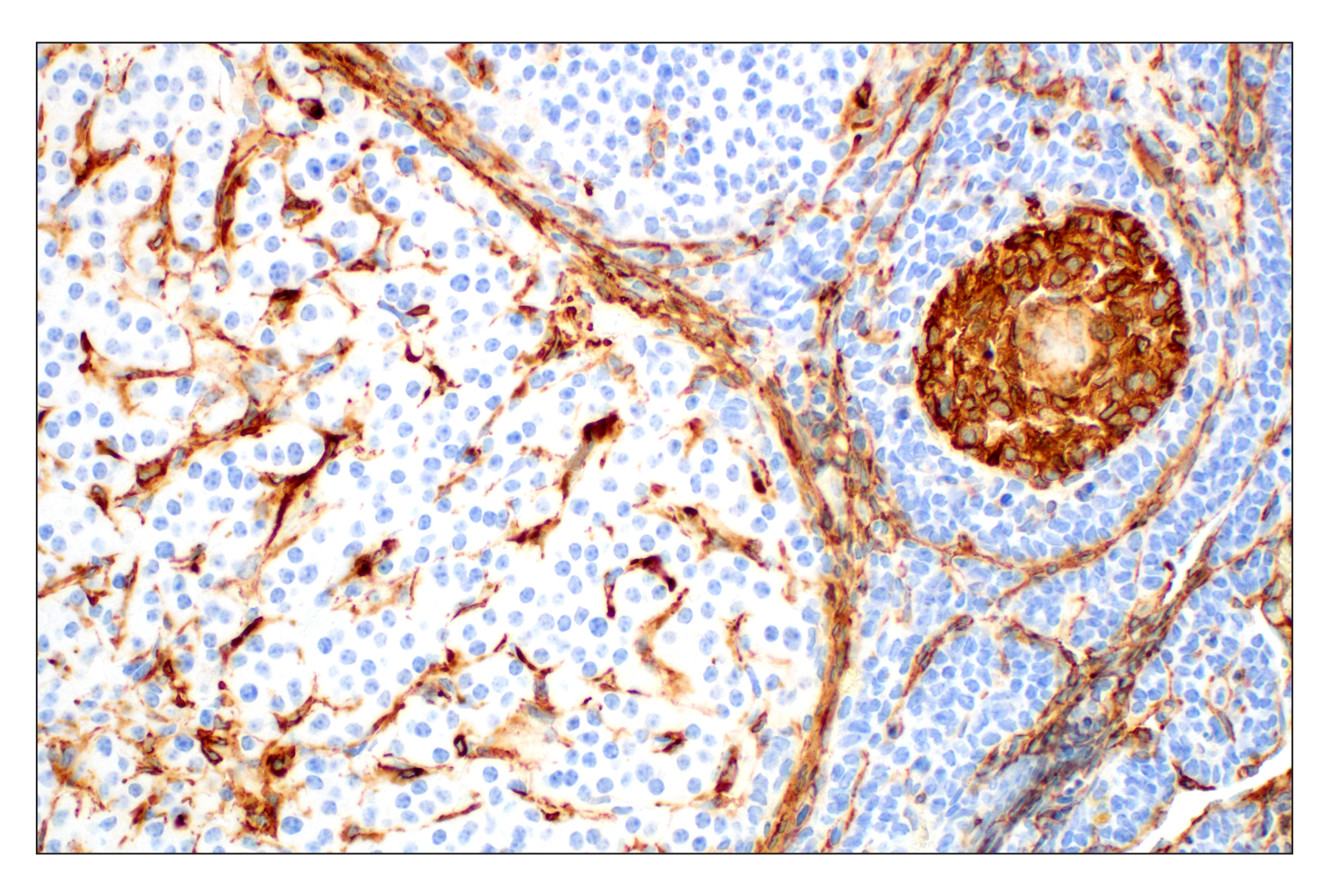 Immunohistochemistry Image 6: α-Smooth Muscle Actin (1A4) Mouse mAb (BSA and Azide Free)