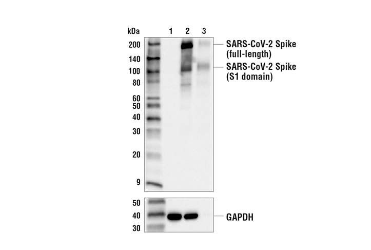 Western Blotting Image 1: SARS-CoV-2 Spike Protein (RBD) (E2T6M) Mouse mAb