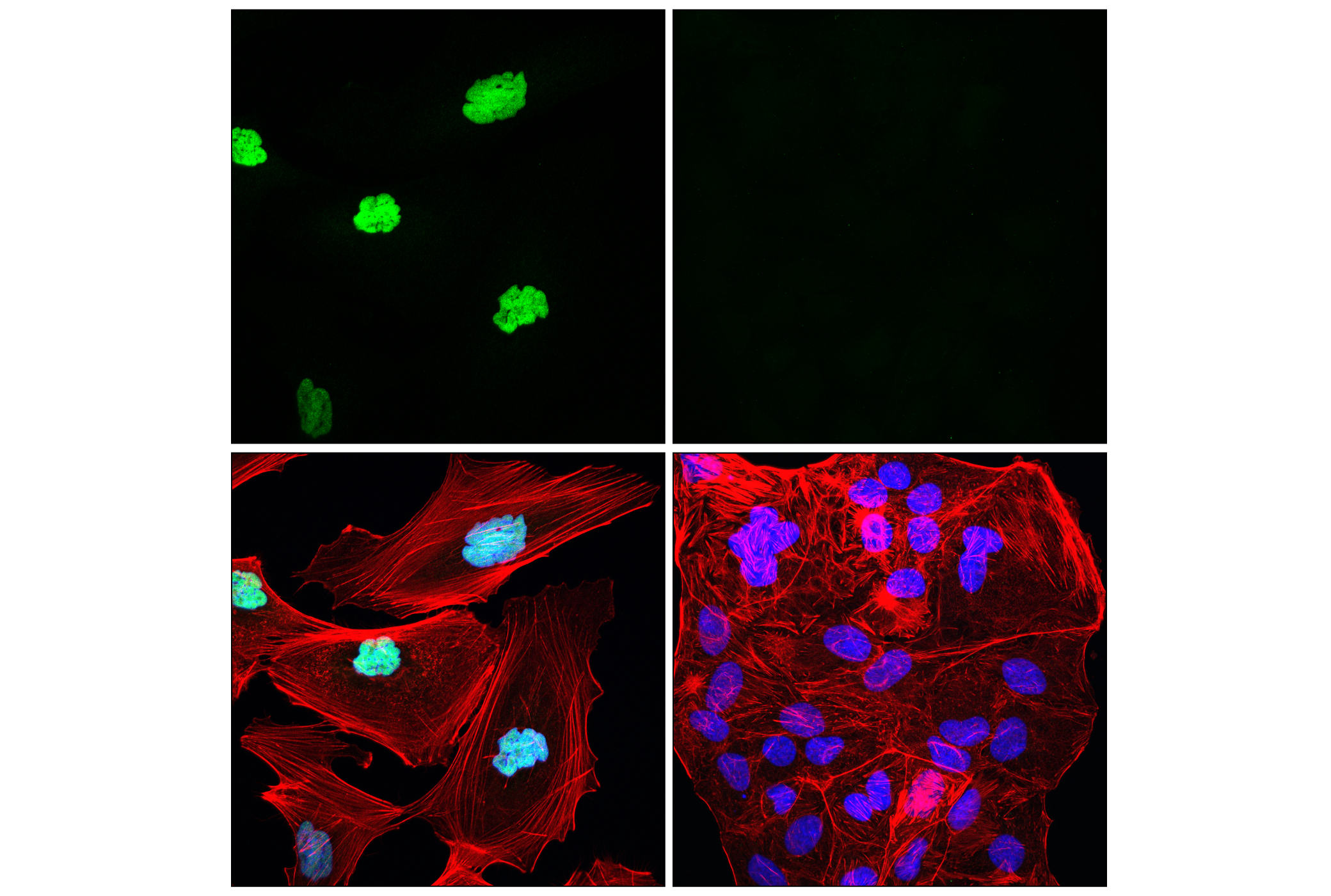 Immunofluorescence Image 1: NFI-A (E6Z1R) Rabbit mAb