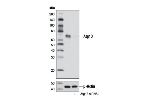 Western Blotting Image 1: Atg13 Antibody