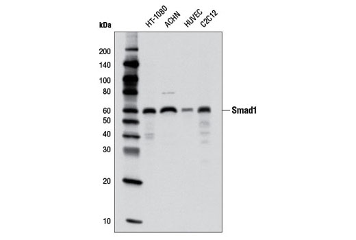  Image 5: Smad 1/5/9 Antibody Sampler Kit