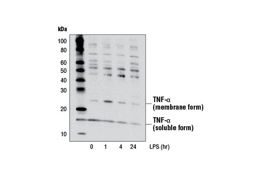 Image 14: Senescence Marker Antibody Sampler Kit