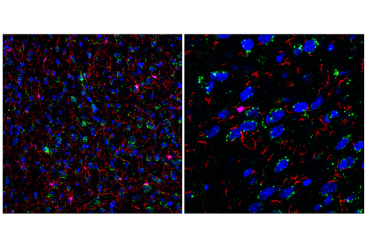 Immunofluorescence Image 1: LIMP-2/SCARB2 (E2Z5F) Rabbit mAb (BSA and Azide Free)