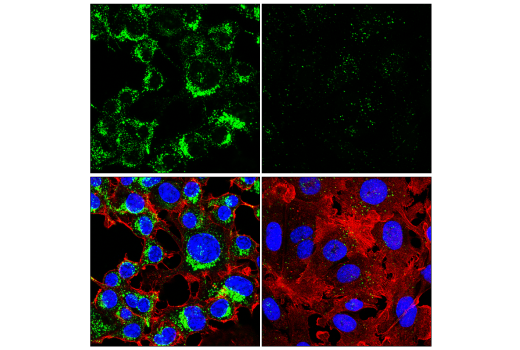 Immunofluorescence Image 3: LIMP-2/SCARB2 (E2Z5F) Rabbit mAb (BSA and Azide Free)