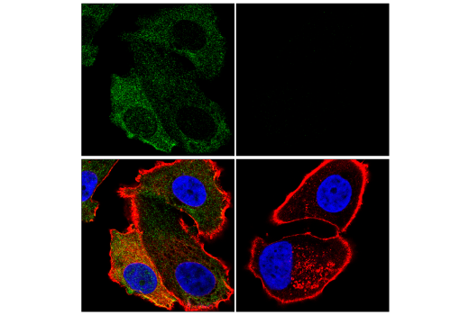 Immunofluorescence Image 1: Gasdermin D (E5O4N) Rabbit mAb