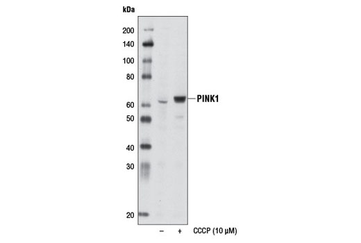  Image 16: Mitophagy Antibody Sampler Kit