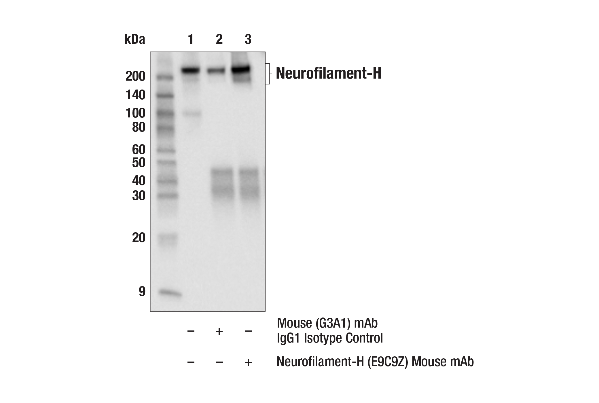 Immunoprecipitation Image 1: Neurofilament-H (E9C9Z) Mouse mAb