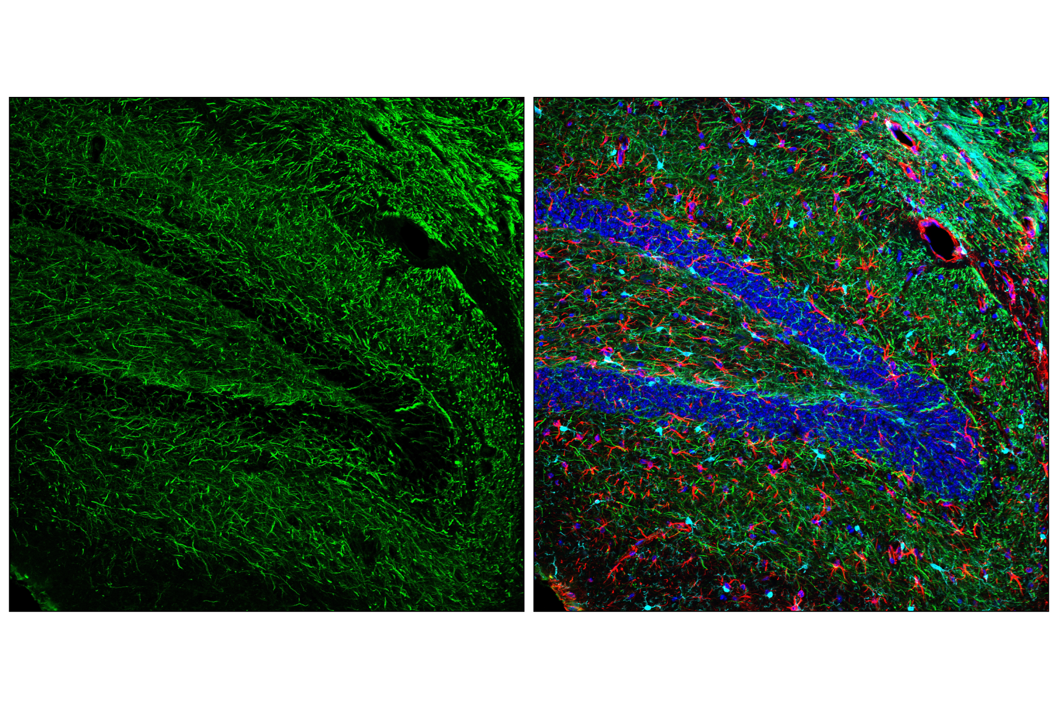 Immunofluorescence Image 1: Neurofilament-H (E9C9Z) Mouse mAb
