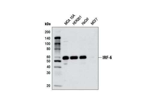  Image 8: IRF Family Antibody Sampler Kit