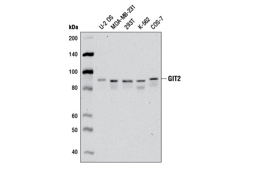 Western Blotting Image 1: GIT2 Antibody