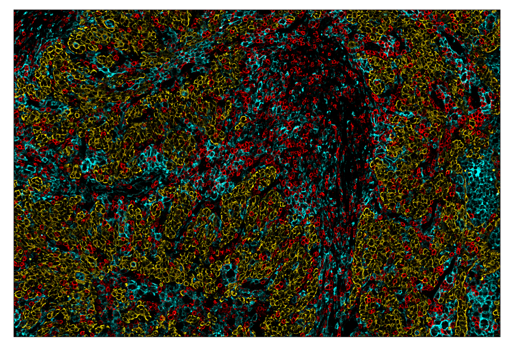 Immunohistochemistry Image 9: SIRPα/SHPS1 (D6I3M) & CO-0034-647 SignalStar™ Oligo-Antibody Pair