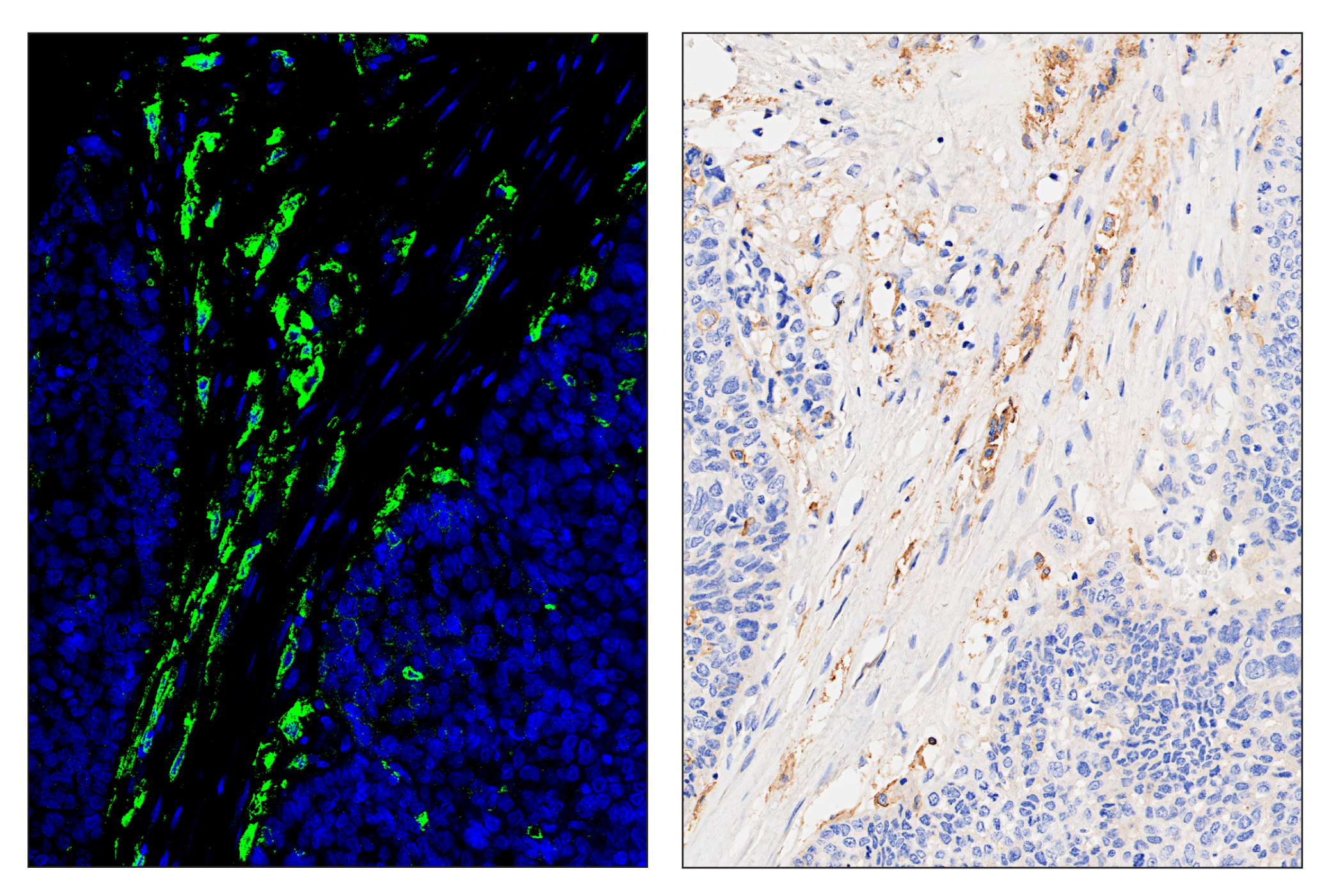 Immunohistochemistry Image 6: SIRPα/SHPS1 (D6I3M) & CO-0034-488 SignalStar™ Oligo-Antibody Pair