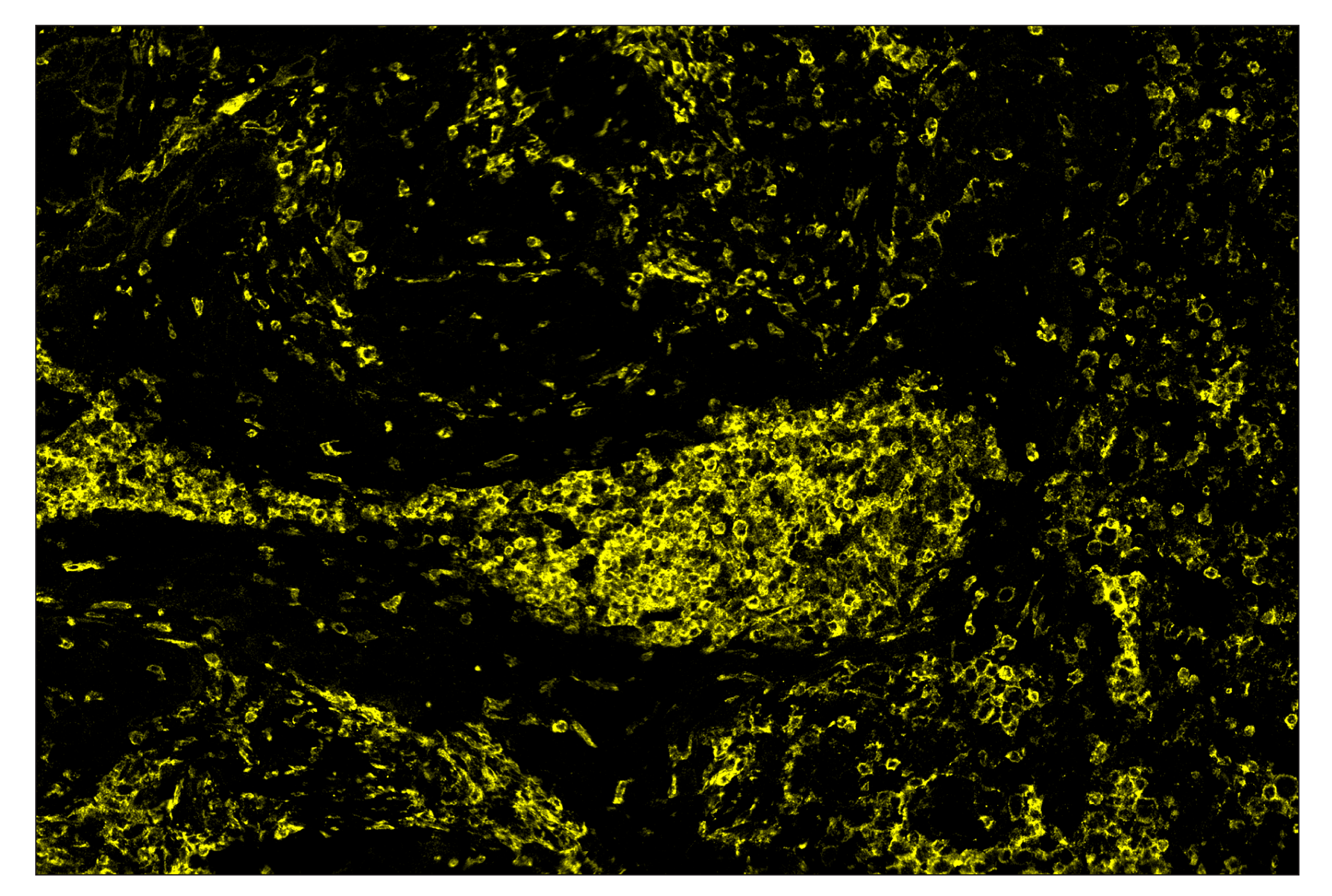 Immunohistochemistry Image 3: SIRPα/SHPS1 (D6I3M) & CO-0034-647 SignalStar™ Oligo-Antibody Pair