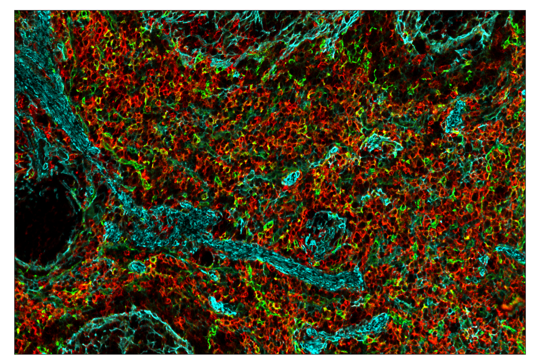 Immunohistochemistry Image 10: SIRPα/SHPS1 (D6I3M) & CO-0034-594 SignalStar™ Oligo-Antibody Pair