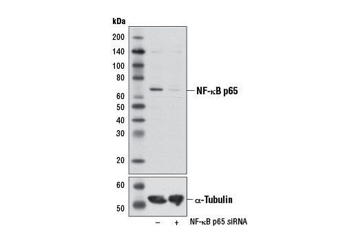  Image 11: NF-κB p65 Antibody Sampler Kit