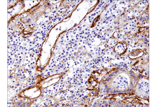 Immunohistochemistry Image 2: Integrin β1 (D6S1W) Rabbit mAb (BSA and Azide Free)