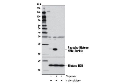 Western Blotting Image 1: Phospho-Histone H2B (Ser14) (D67H2) Rabbit mAb