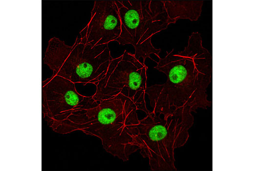 Immunofluorescence Image 1: Bmi1 (D20B7) XP® Rabbit mAb