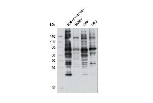  Image 10: Phospho-(Ser/Thr) Kinase Substrate Antibody Sampler Kit