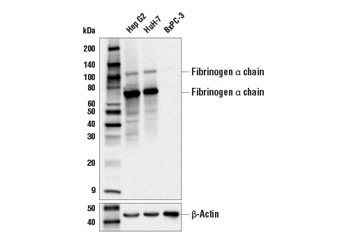 Western Blotting Image 1: Fibrinogen alpha chain Antibody
