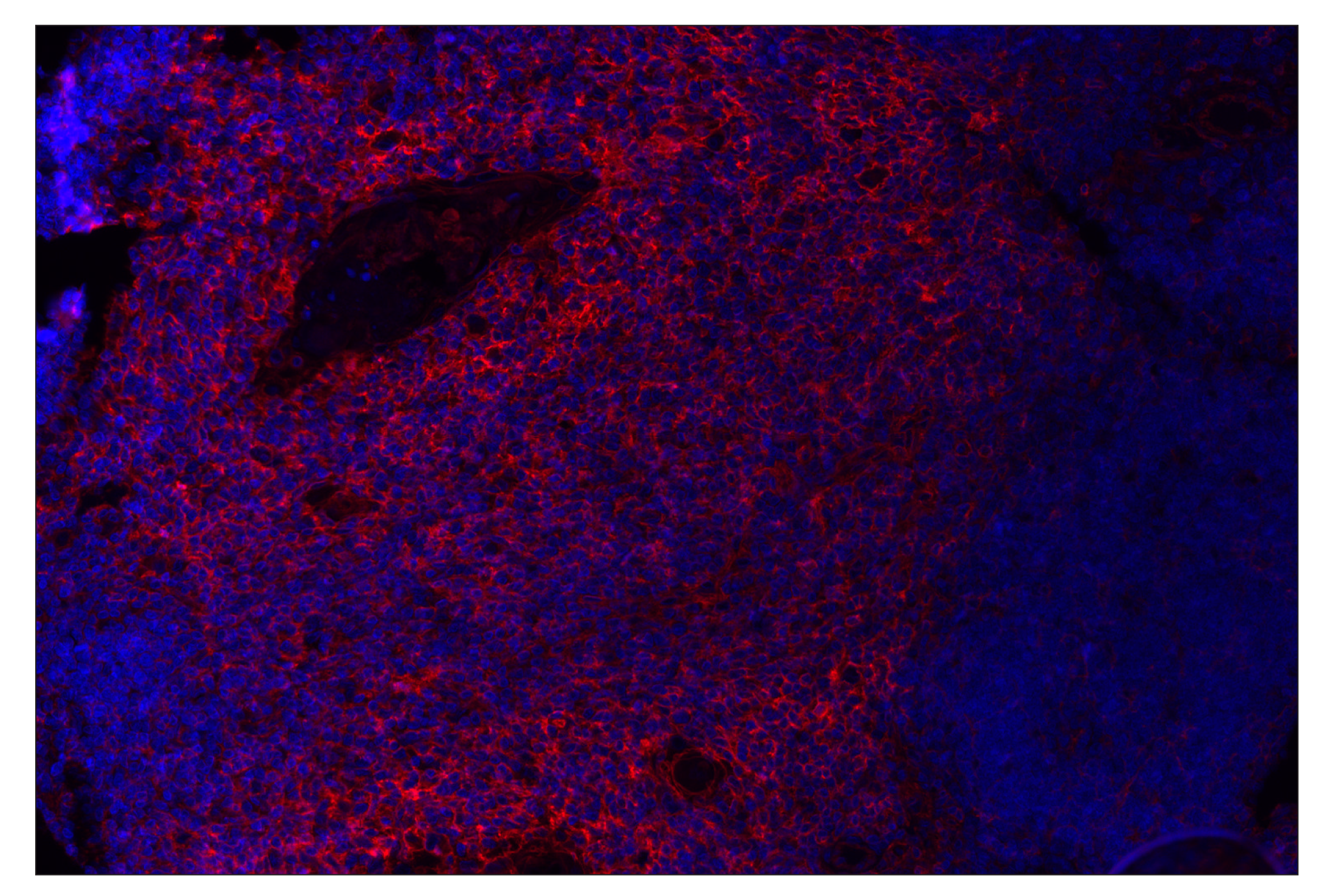 Immunohistochemistry Image 1: MHC Class I (EMR8-5) Mouse mAb (Alexa Fluor® 647 Conjugate)