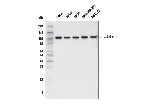 Western Blotting Image 1: α-Actinin (E7U1O) Mouse mAb