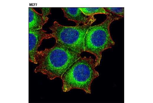 Immunofluorescence Image 1: Rab8A (D22D8) XP® Rabbit mAb
