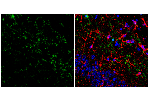 Immunofluorescence Image 1: P2Y12 (E9J1J) Rabbit mAb