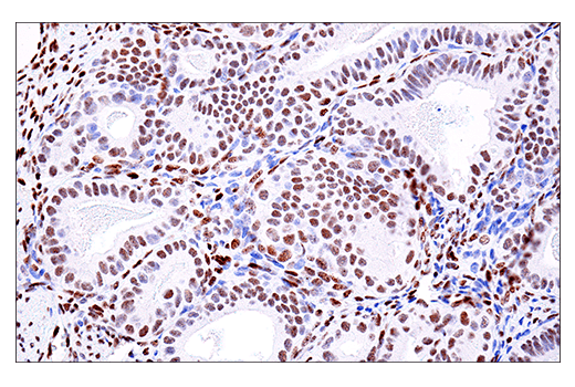 Immunohistochemistry Image 1: PML (E6S9L) Rabbit mAb