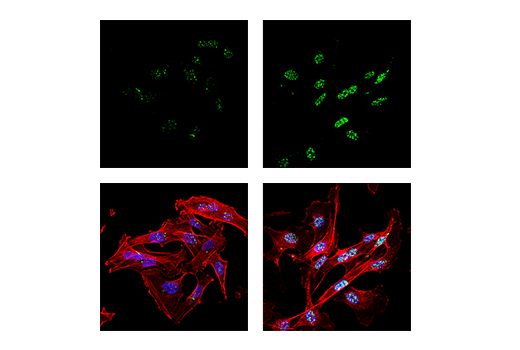 Immunofluorescence Image 2: PML (E6S9L) Rabbit mAb