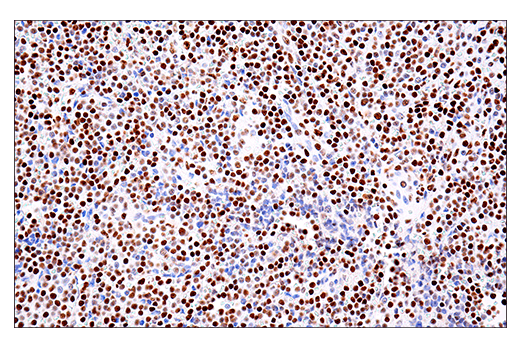 Immunohistochemistry Image 2: PML (E6S9L) Rabbit mAb
