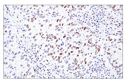 Immunohistochemistry Image 3: PML (E6S9L) Rabbit mAb