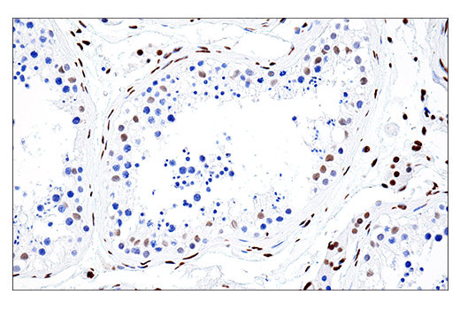 Immunohistochemistry Image 5: PML (E6S9L) Rabbit mAb