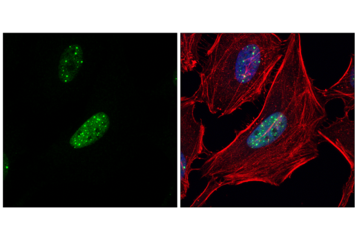 Immunofluorescence Image 3: PML (E6S9L) Rabbit mAb