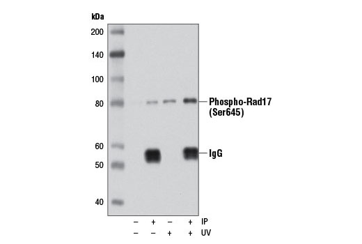 Immunoprecipitation Image 1: Phospho-Rad17 (Ser645) (D5H5) Rabbit mAb