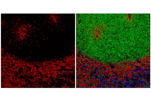 Immunofluorescence Image 1: CD20 (E3N7O) XP® Rabbit mAb (Alexa Fluor® 647 Conjugate)