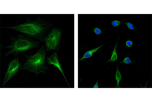 Immunofluorescence Image 1: Cleaved PARP (Asp214) (D64E10) XP® Rabbit mAb (Alexa Fluor® 647 Conjugate)