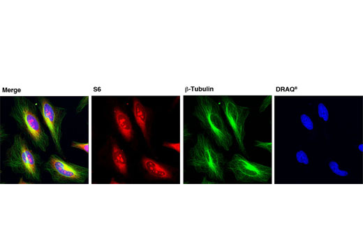 Immunofluorescence Image 1: S6 Ribosomal Protein (54D2) Mouse mAb (Alexa Fluor® 555 Conjugate)
